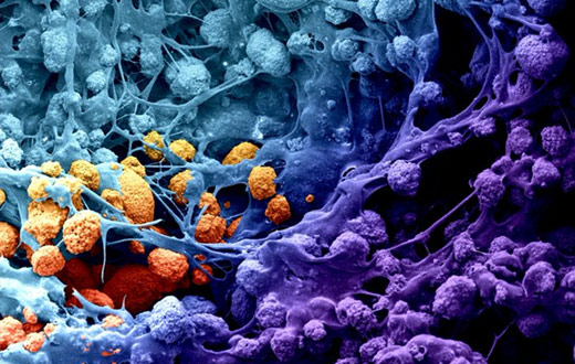 Bone Repair and Regeneration