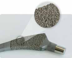 Plasma Coating